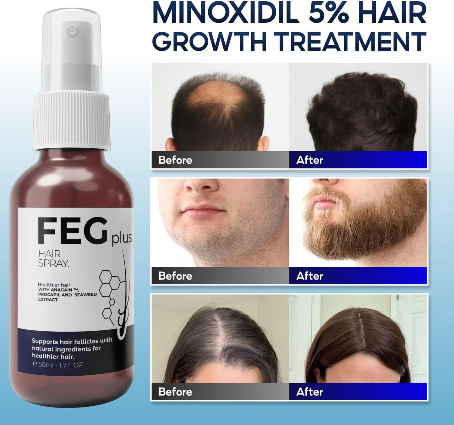 FEG® Advanced Hair Growth Spray – Revitalize Roots & Boost Thickness